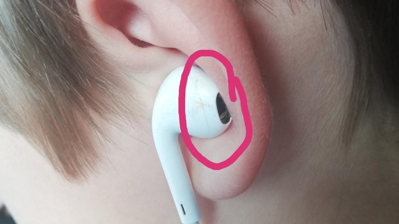 Foto de earbud com bocal de saída de som (nozzle) entupido por sujeira e cera de ouvido.