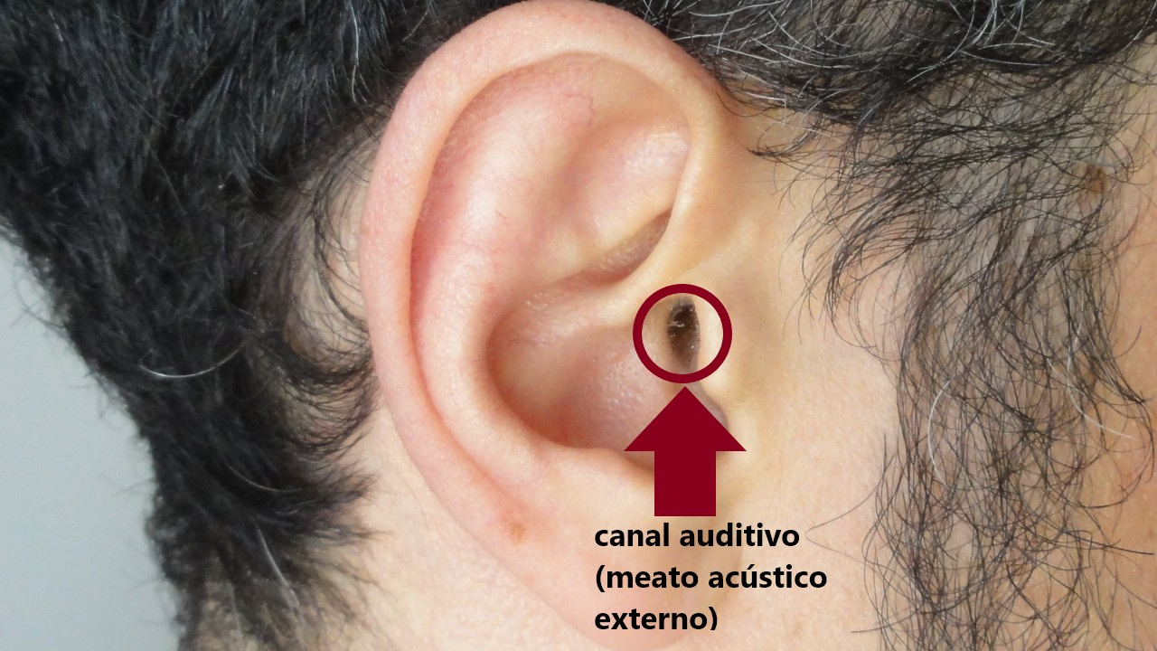 Canal auditivo (meato acústico externo).
